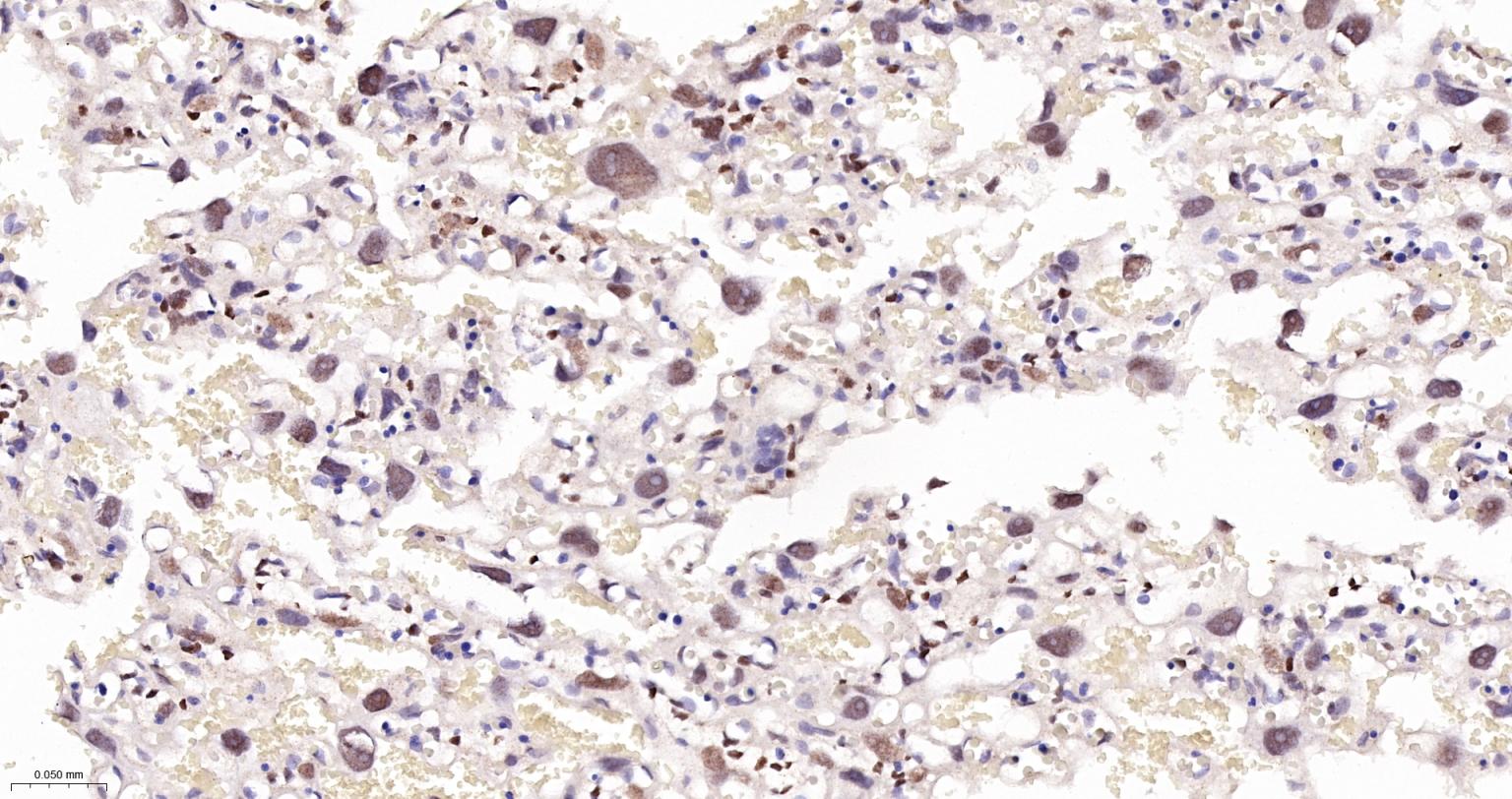 TEAD1重组兔单抗-bsm-63274R