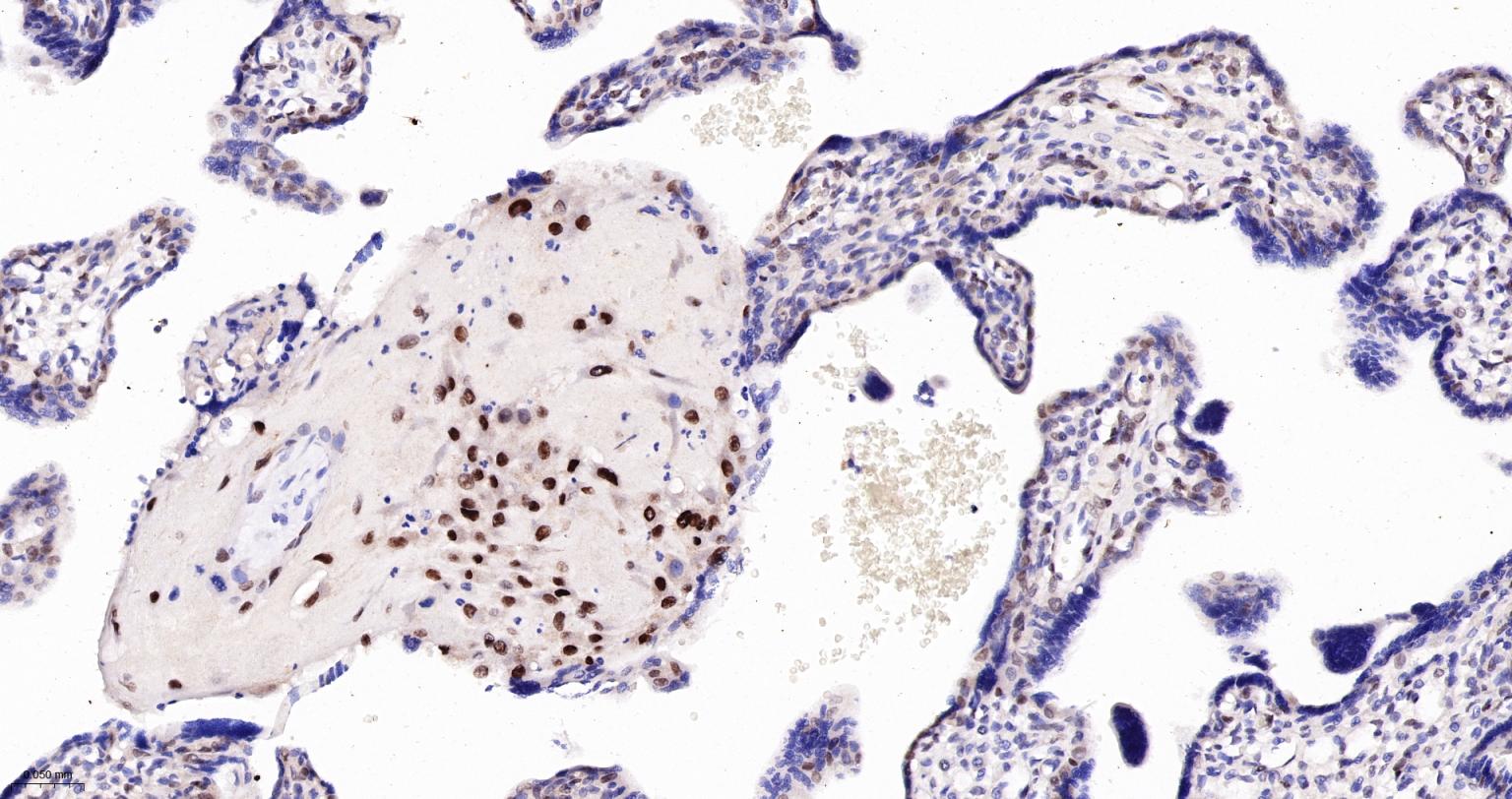TEAD1重组兔单抗-bsm-63274R