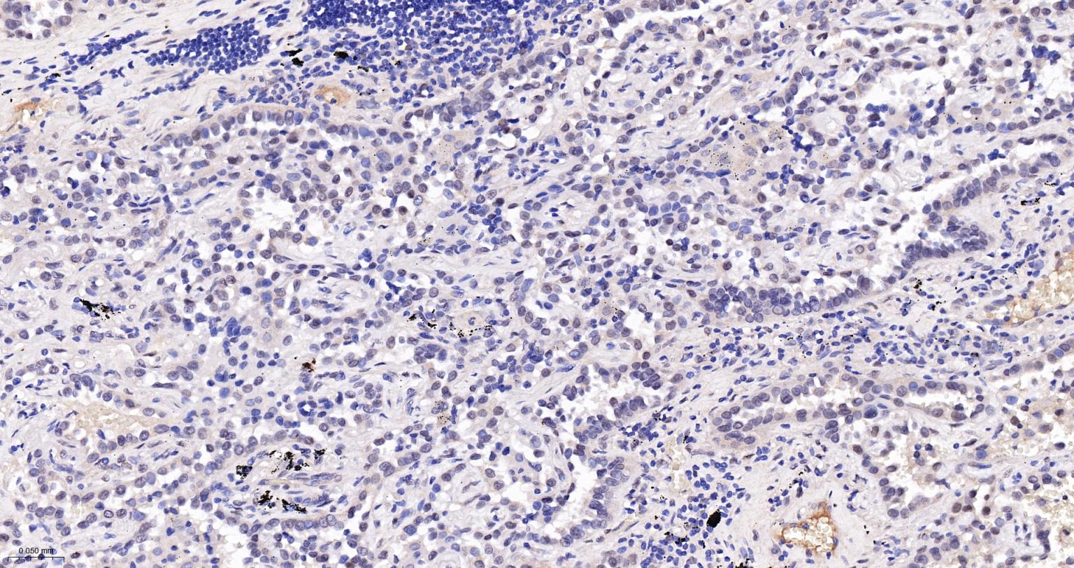 TEAD1重组兔单抗-bsm-63274R