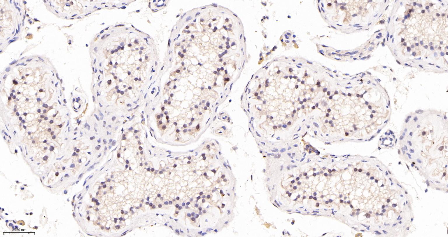 TEAD1重组兔单抗-bsm-63274R