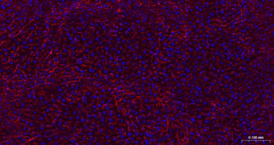 N-钙粘附分子重组兔单抗-bsm-52389R
