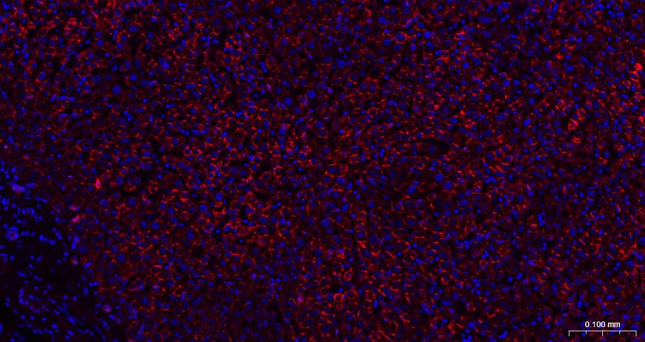 N-钙粘附分子重组兔单抗-bsm-52389R