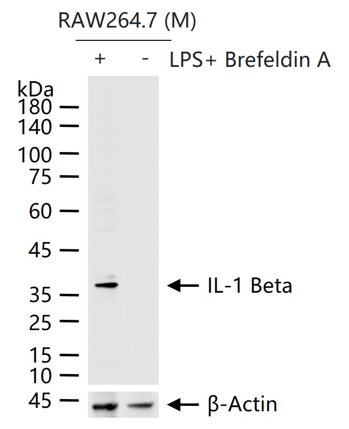 白介素1β抗体-bs-6319R