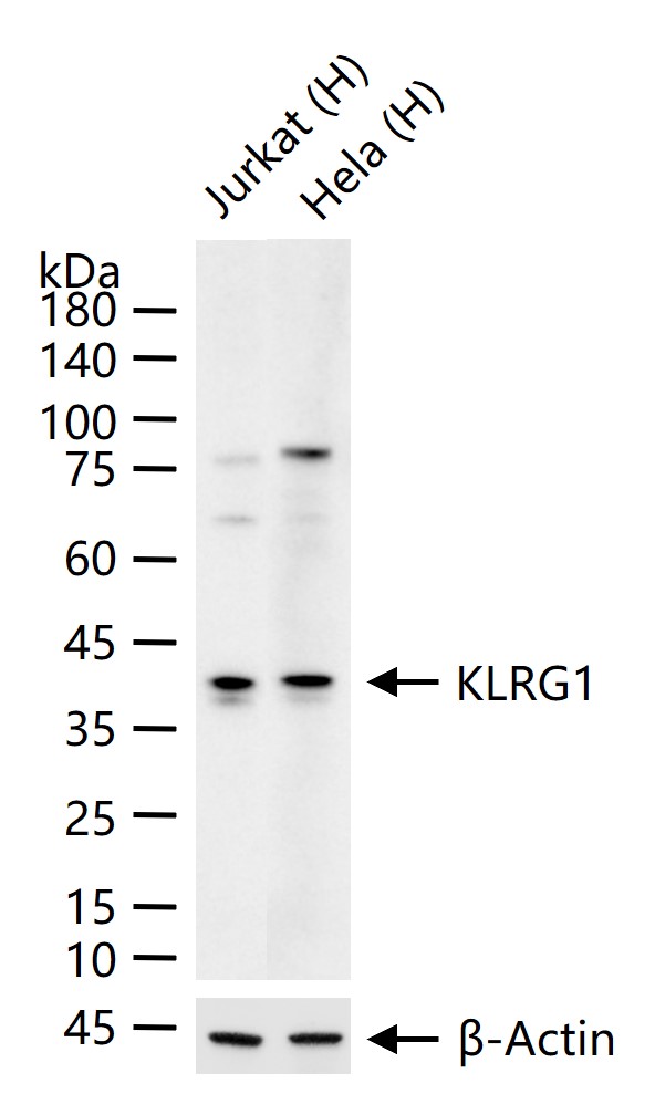 KLRG1重组兔单抗-bsm-62195R
