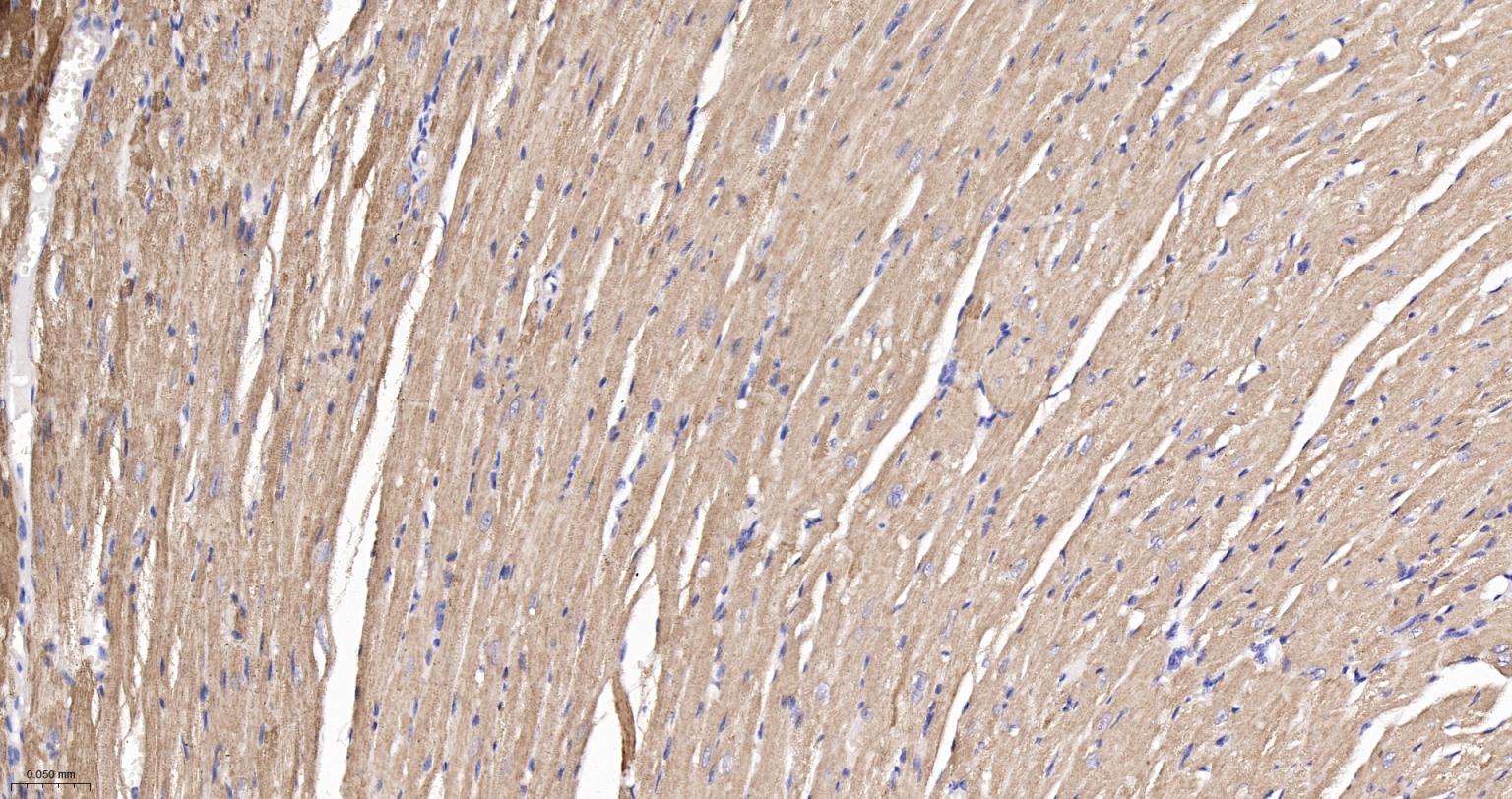 线粒体异柠檬酸脱氢酶重组兔单抗-bsm-61585R