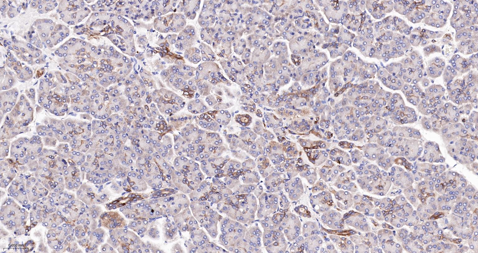 核因子κB抑制蛋白E重组兔单抗-bsm-61720R
