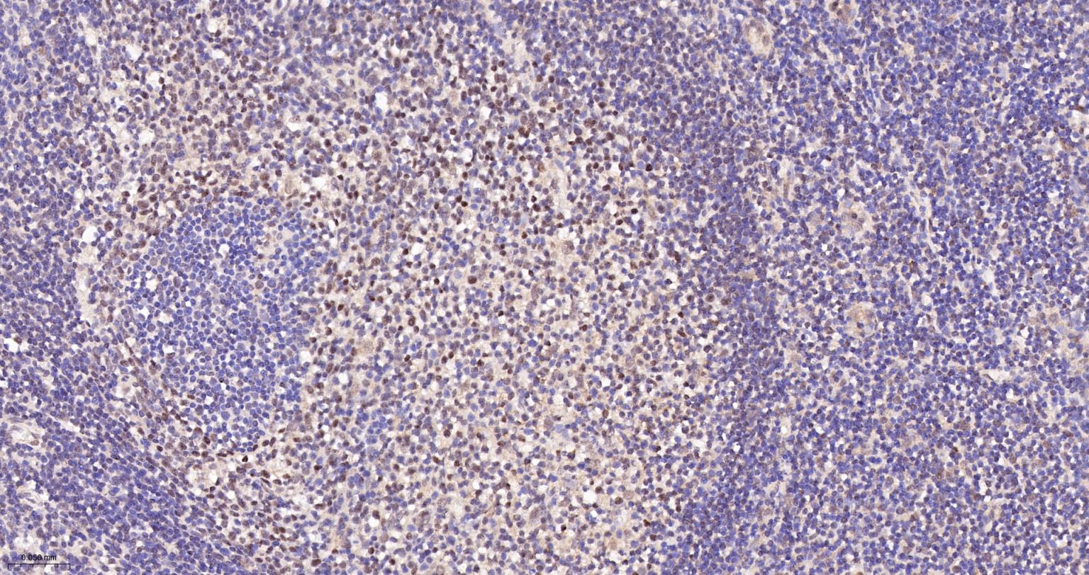 端粒结合蛋白2重组兔单抗-bsm-61777R