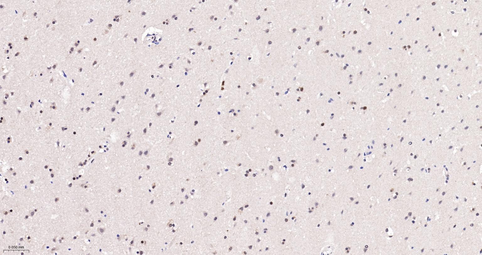 端粒结合蛋白2重组兔单抗-bsm-61777R