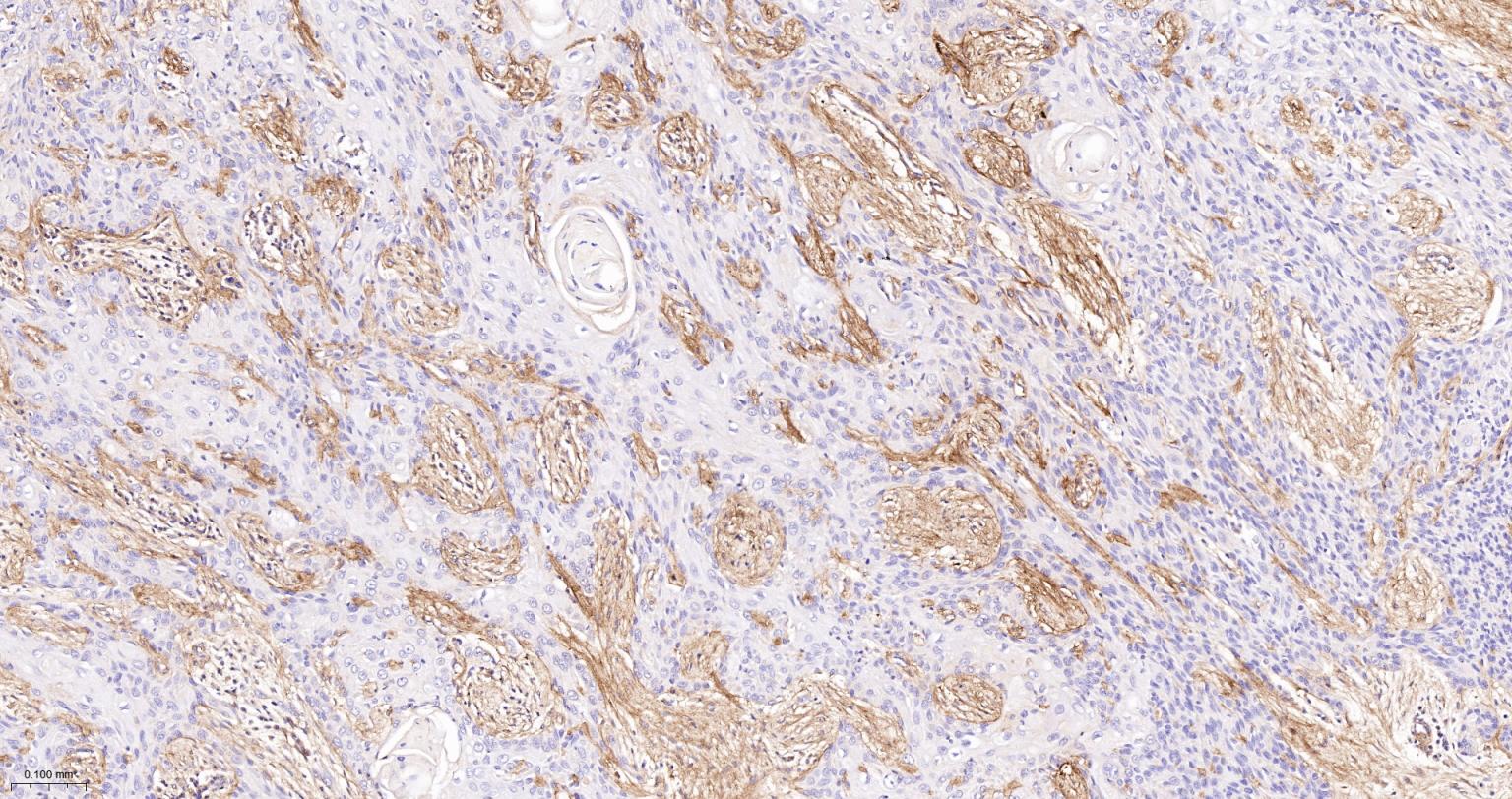 6型胶原重组兔单抗-bsm-61026R