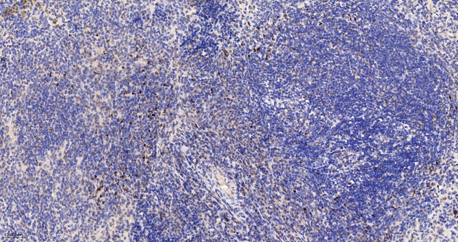 DNA甲基转移酶-3α重组兔单抗-bsm-61213R
