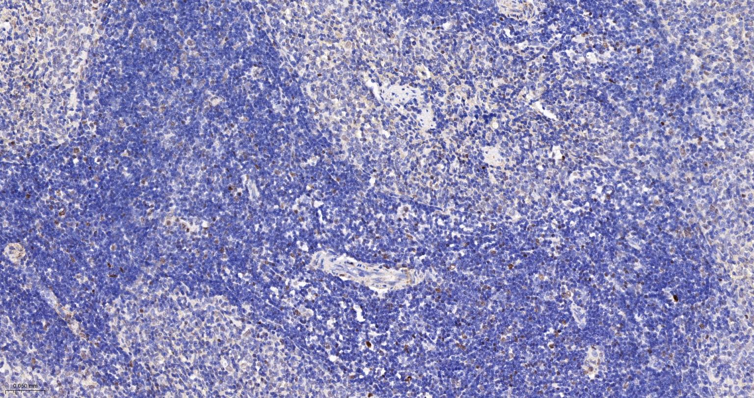 DNA甲基转移酶-3α重组兔单抗-bsm-61213R