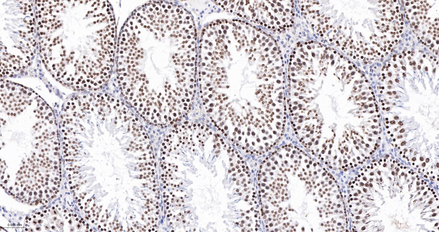 高迁移率族蛋白A1重组兔单抗-bsm-61985R