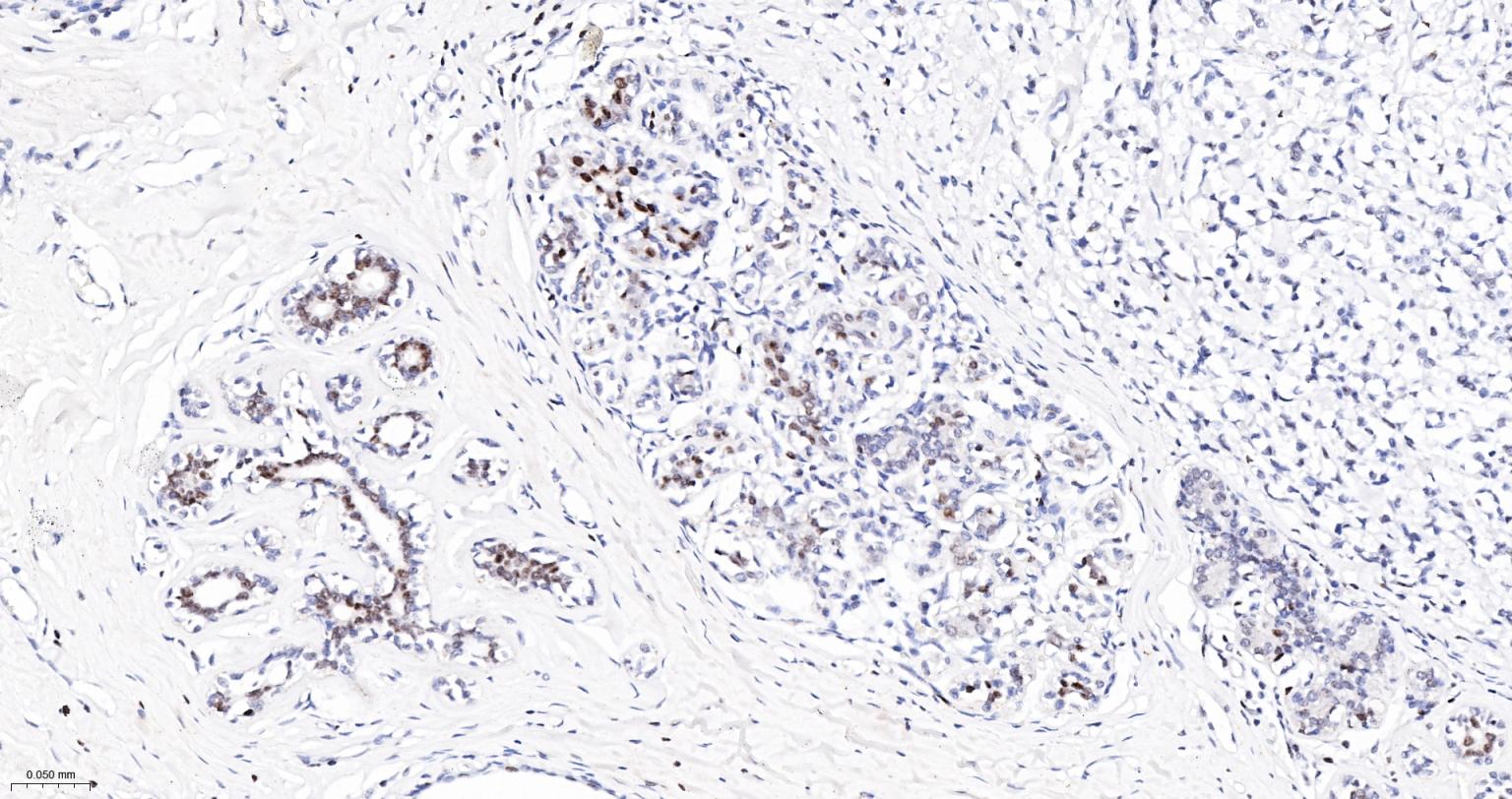 高迁移率族蛋白A1重组兔单抗-bsm-61985R