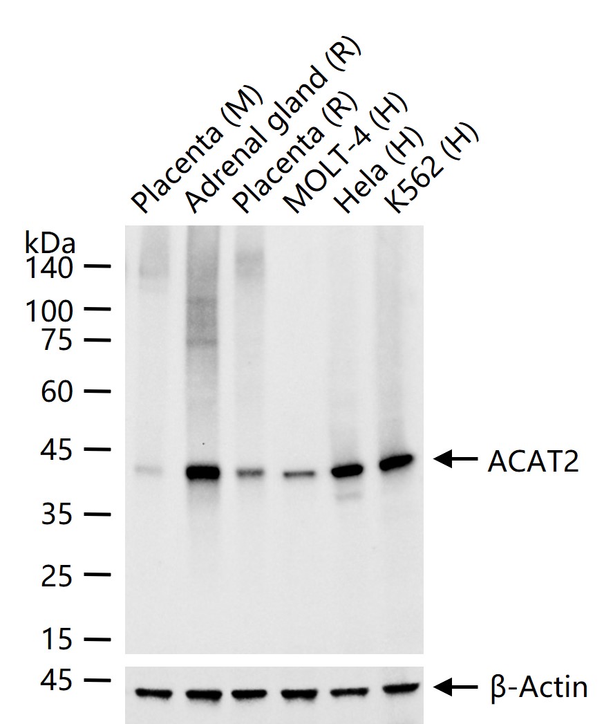 ACAT2重组兔单抗-bsm-62494R