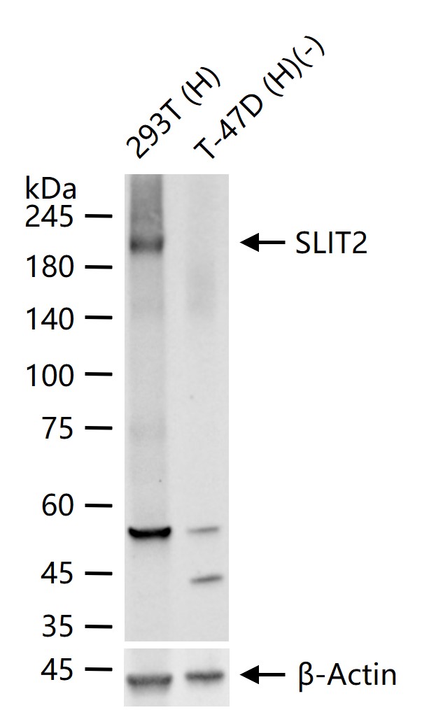 神经迁移蛋白Slit2/3重组兔单抗-bsm-61608R