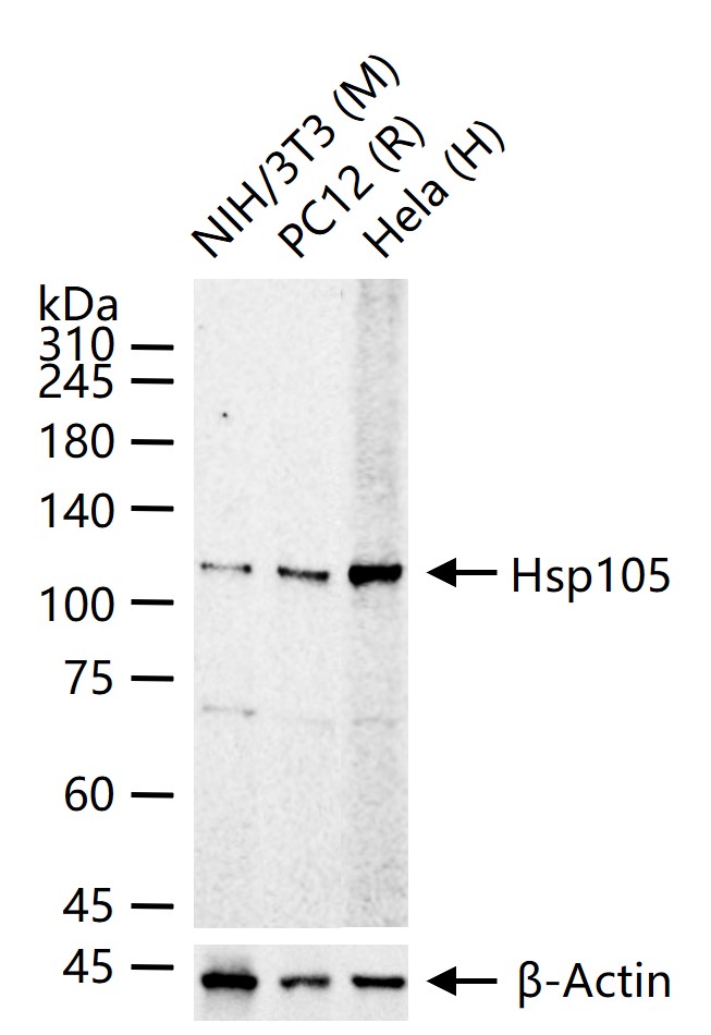 热休克蛋白105重组兔单抗-bsm-61340R