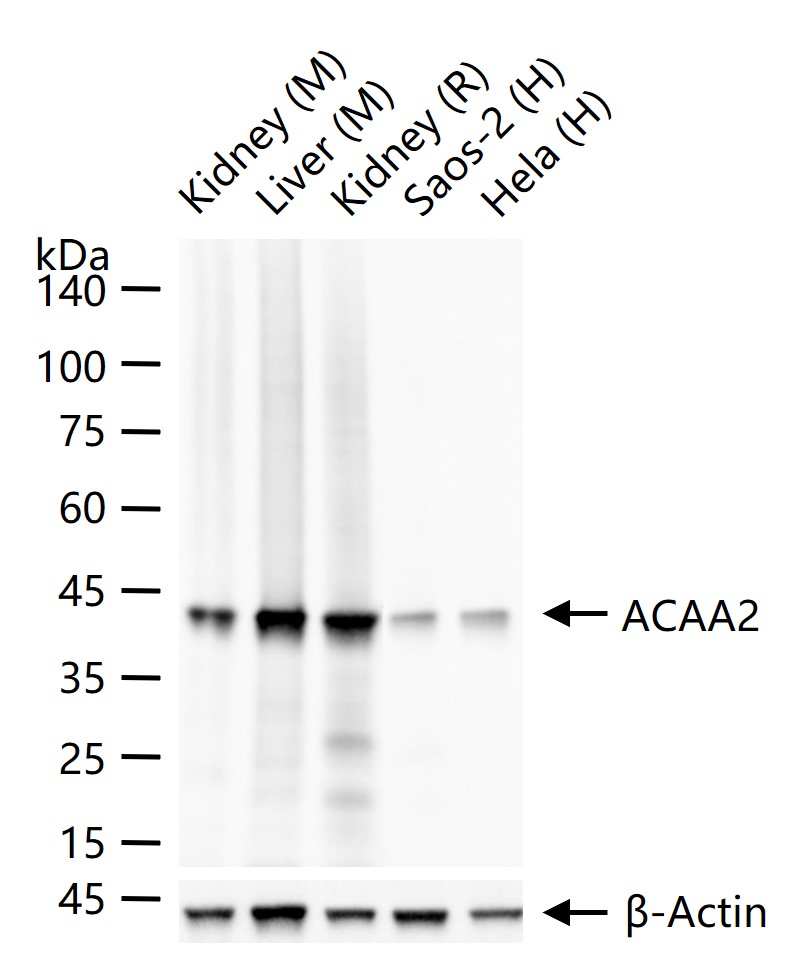 ACAA2重组兔单抗-bsm-62464R