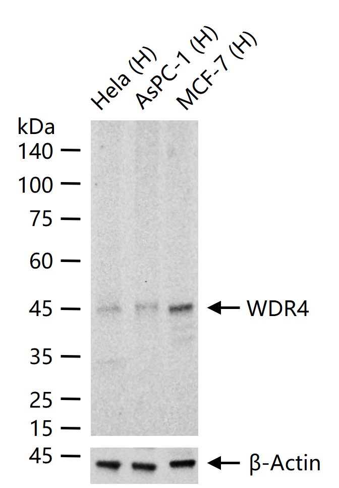 WDR4重组兔单抗-bsm-62341R