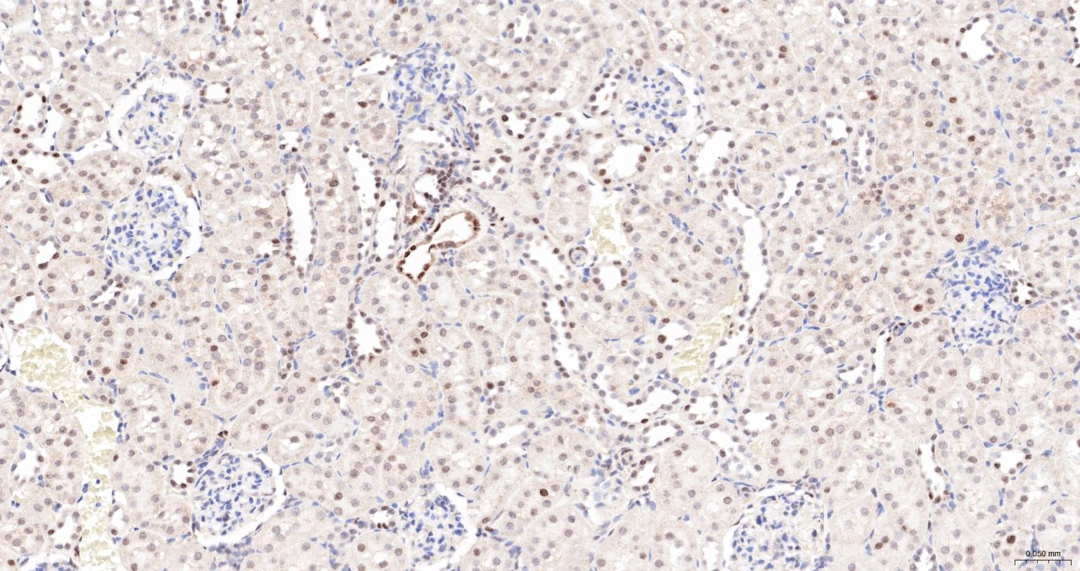 核孔复合蛋白Nup98重组兔单抗-bsm-61197R