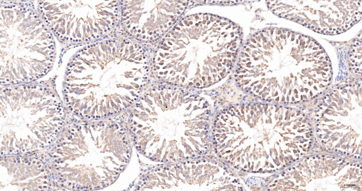 热休克蛋白105重组兔单抗-bsm-61340R