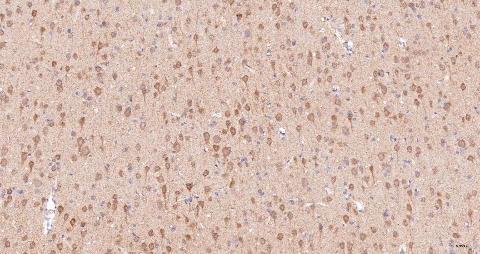 热休克蛋白105重组兔单抗-bsm-61340R