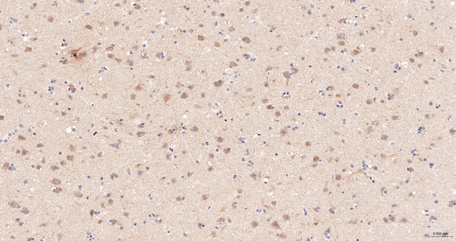 热休克蛋白105重组兔单抗-bsm-61340R