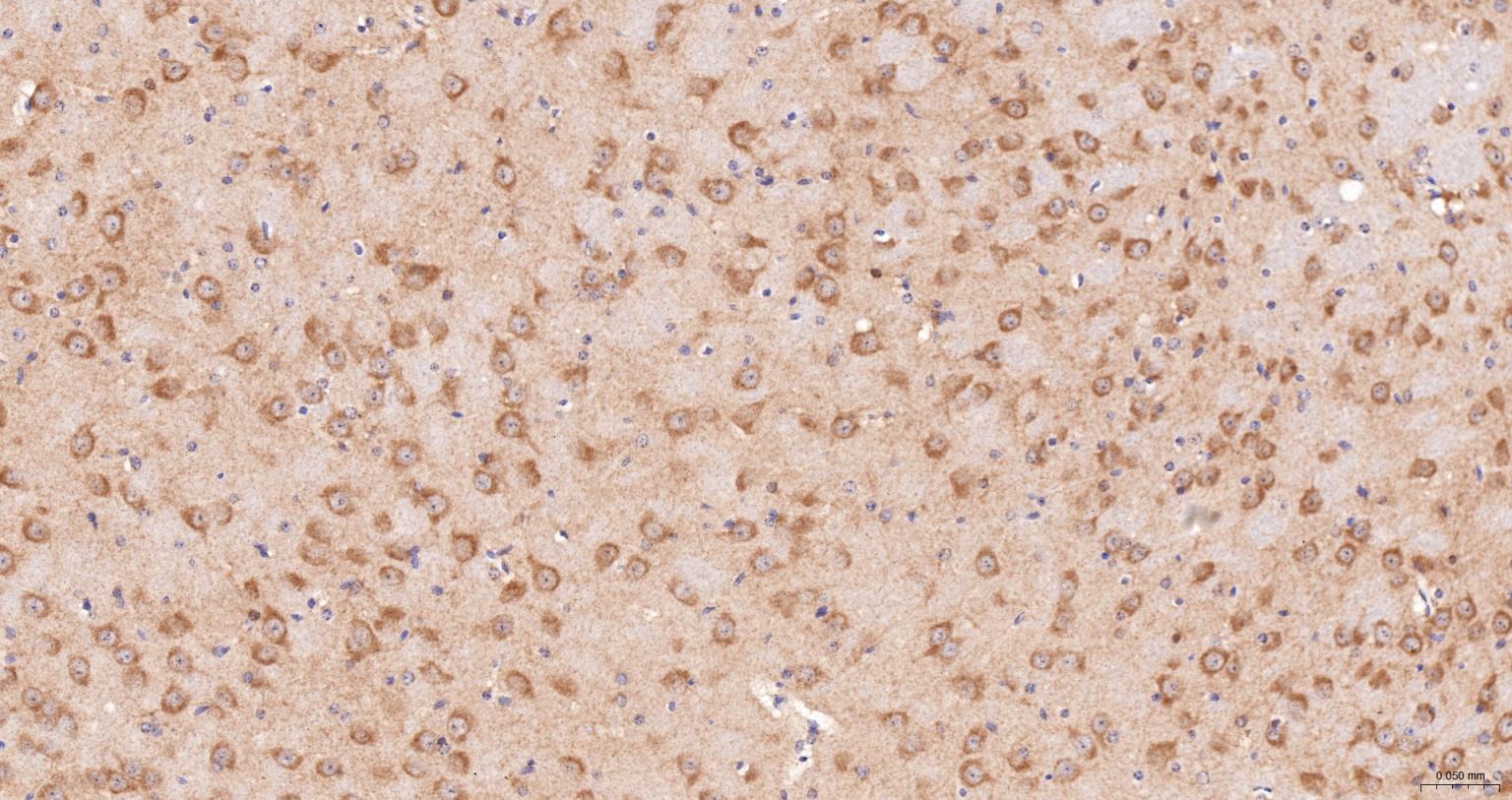热休克蛋白105重组兔单抗-bsm-61340R