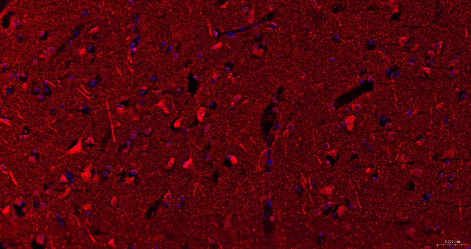神经迁移蛋白Slit2/3重组兔单抗-bsm-61608R
