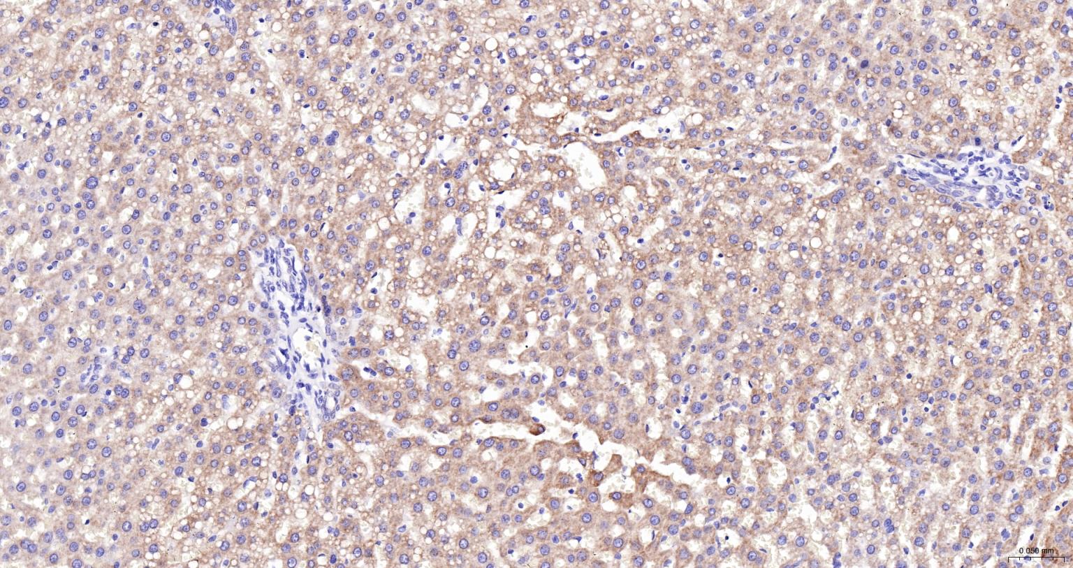 ACAA2重组兔单抗-bsm-62464R