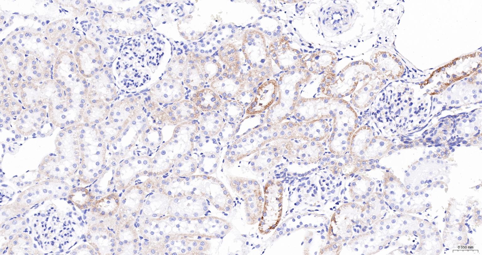ACAA2重组兔单抗-bsm-62464R