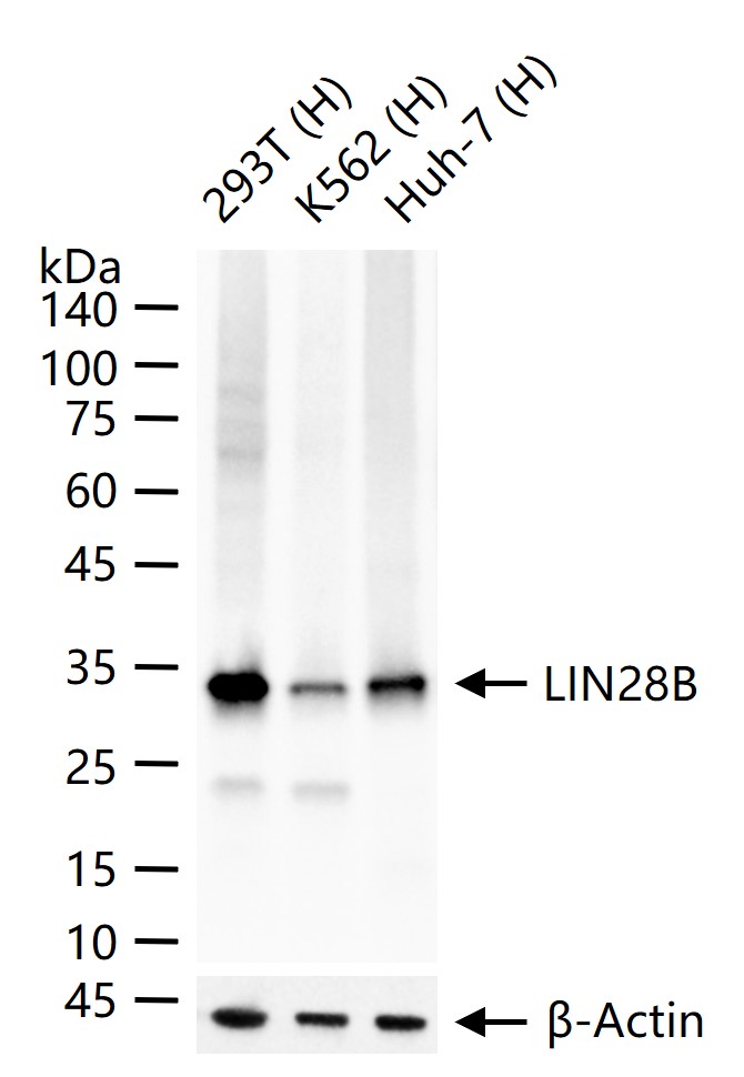 RNA结合蛋白LIN28B重组兔单抗-bsm-61215R
