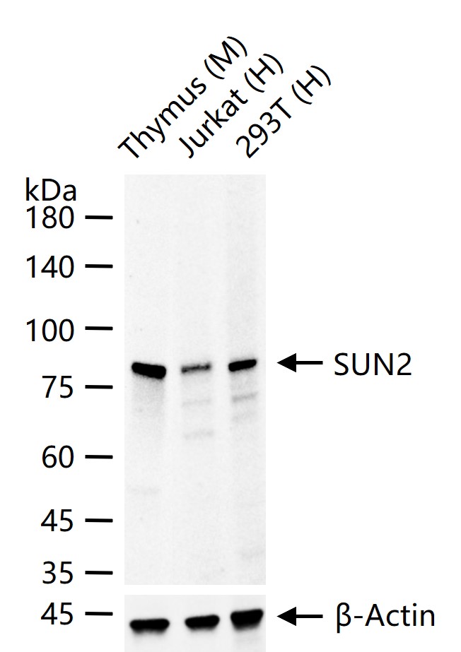 SUN2重组兔单抗-bsm-54421R