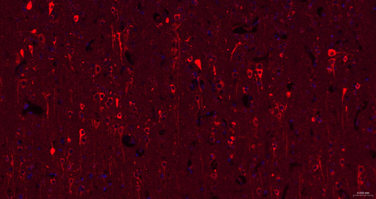 瘦素受体重组兔单抗-bsm-61055R