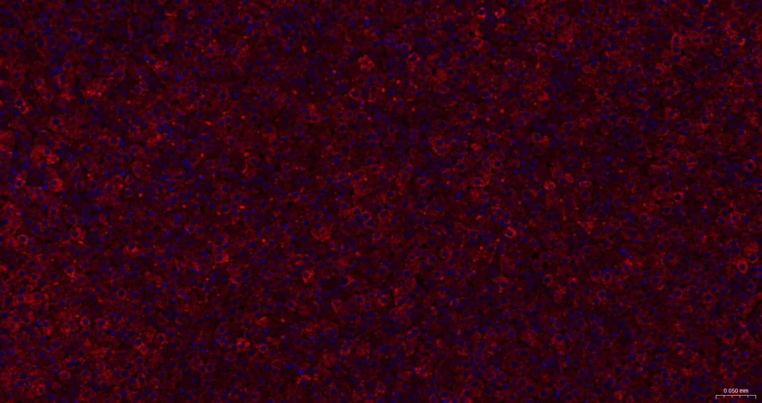 ACAA2重组兔单抗-bsm-62464R