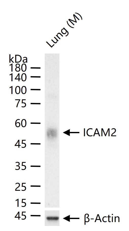 细胞间粘附分子-2（CD102）重组兔单抗-bsm-62574R