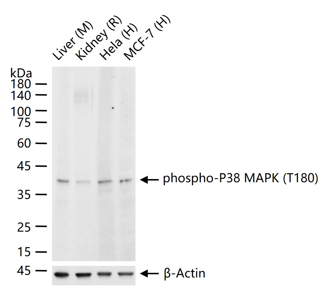 磷酸化p38MAPK重组兔单抗-bsm-63316R