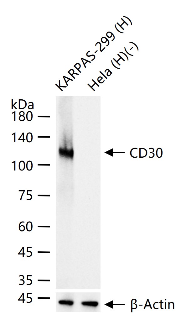CD30重组兔单抗-bsm-54798R