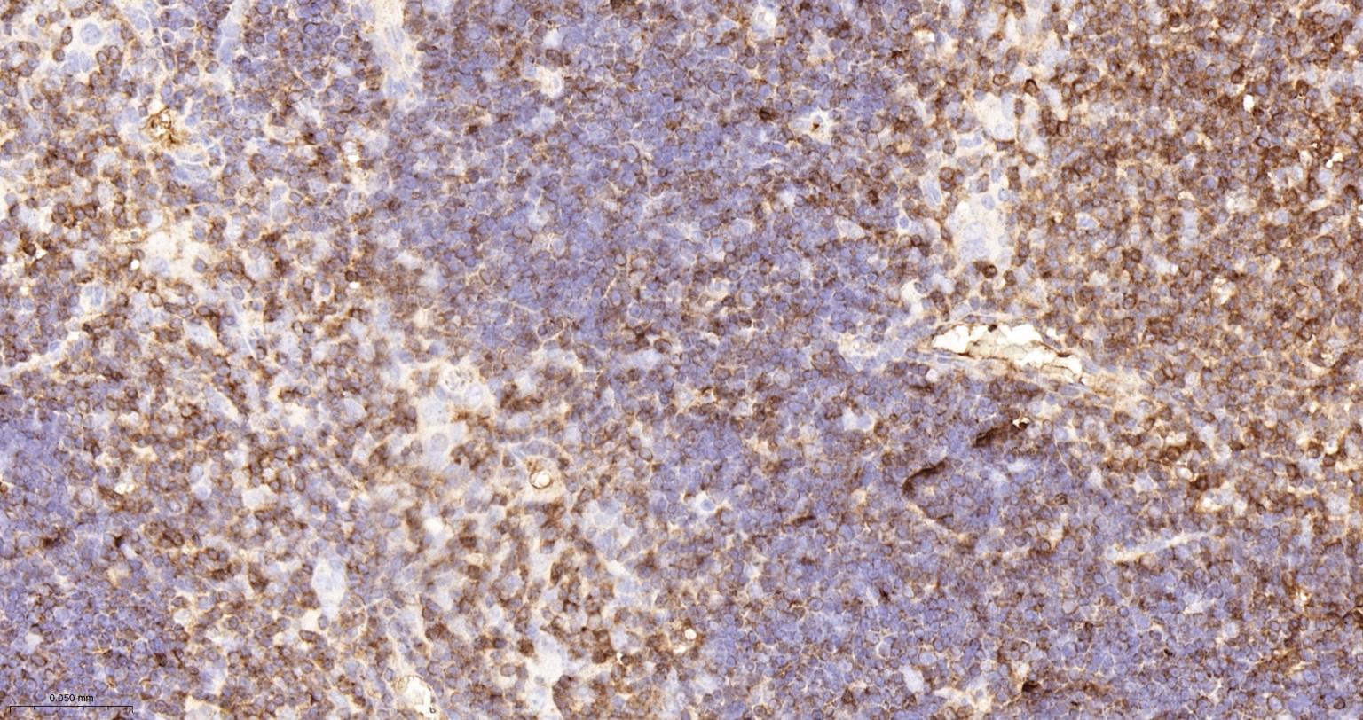 CD3/CD3-ε重组兔单抗-bsm-60002R