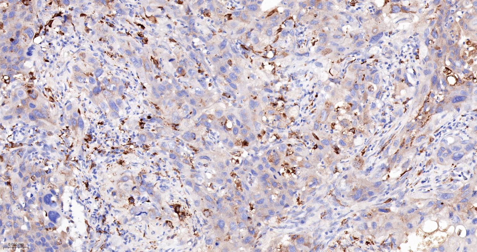 组织蛋白酶B重组兔单抗-bsm-61441R