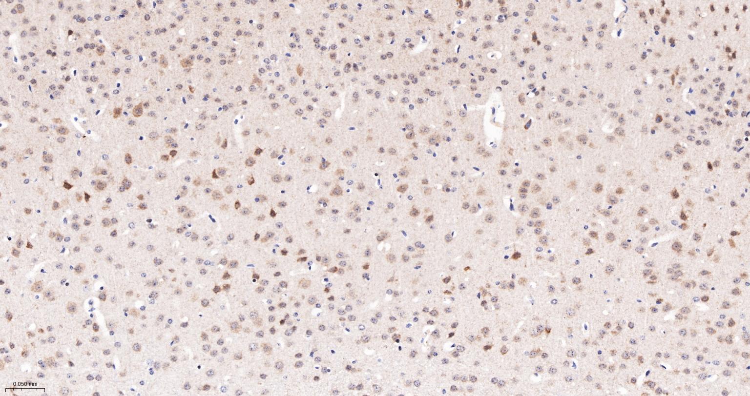 Jun激活区域-连接蛋白1重组兔单抗-bsm-61721R