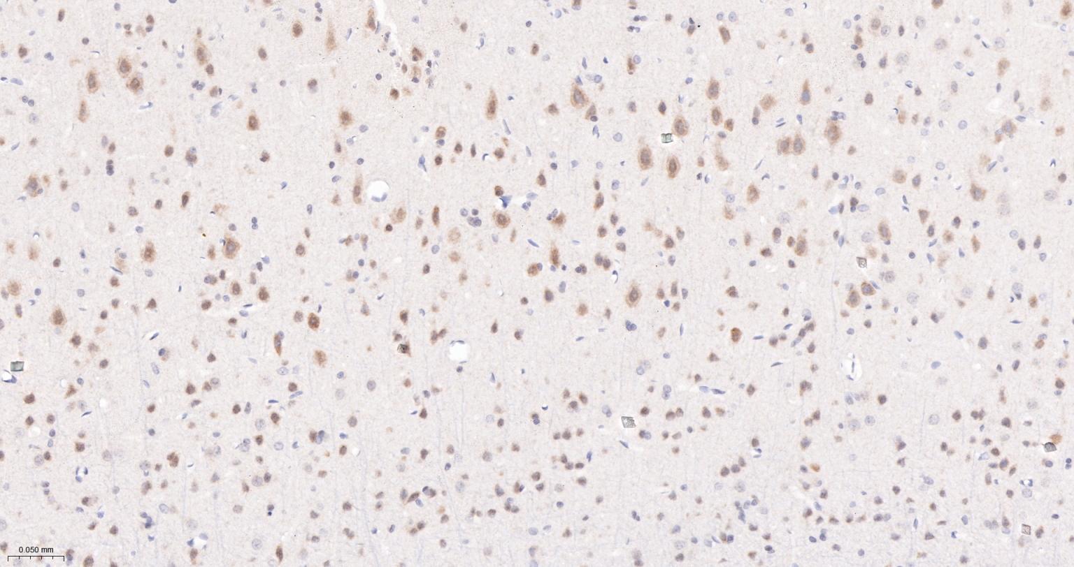Jun激活区域-连接蛋白1重组兔单抗-bsm-61721R