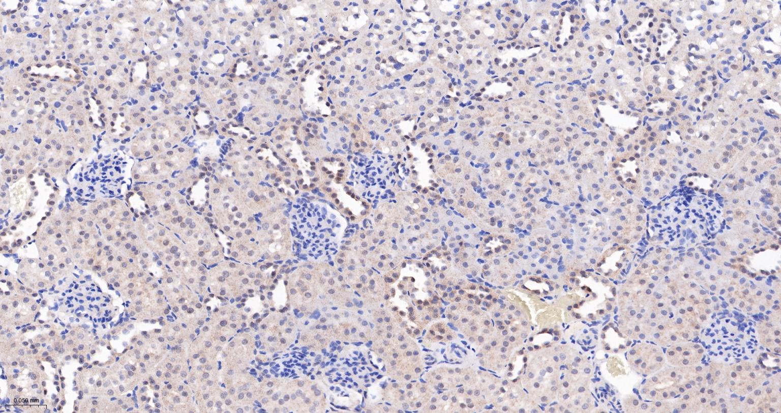Jun激活区域-连接蛋白1重组兔单抗-bsm-61721R