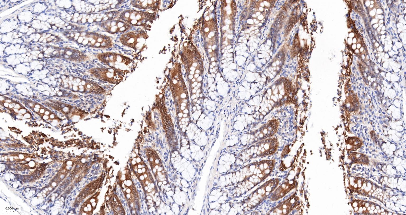 ALKBH1蛋白重组兔单抗-bsm-61168R