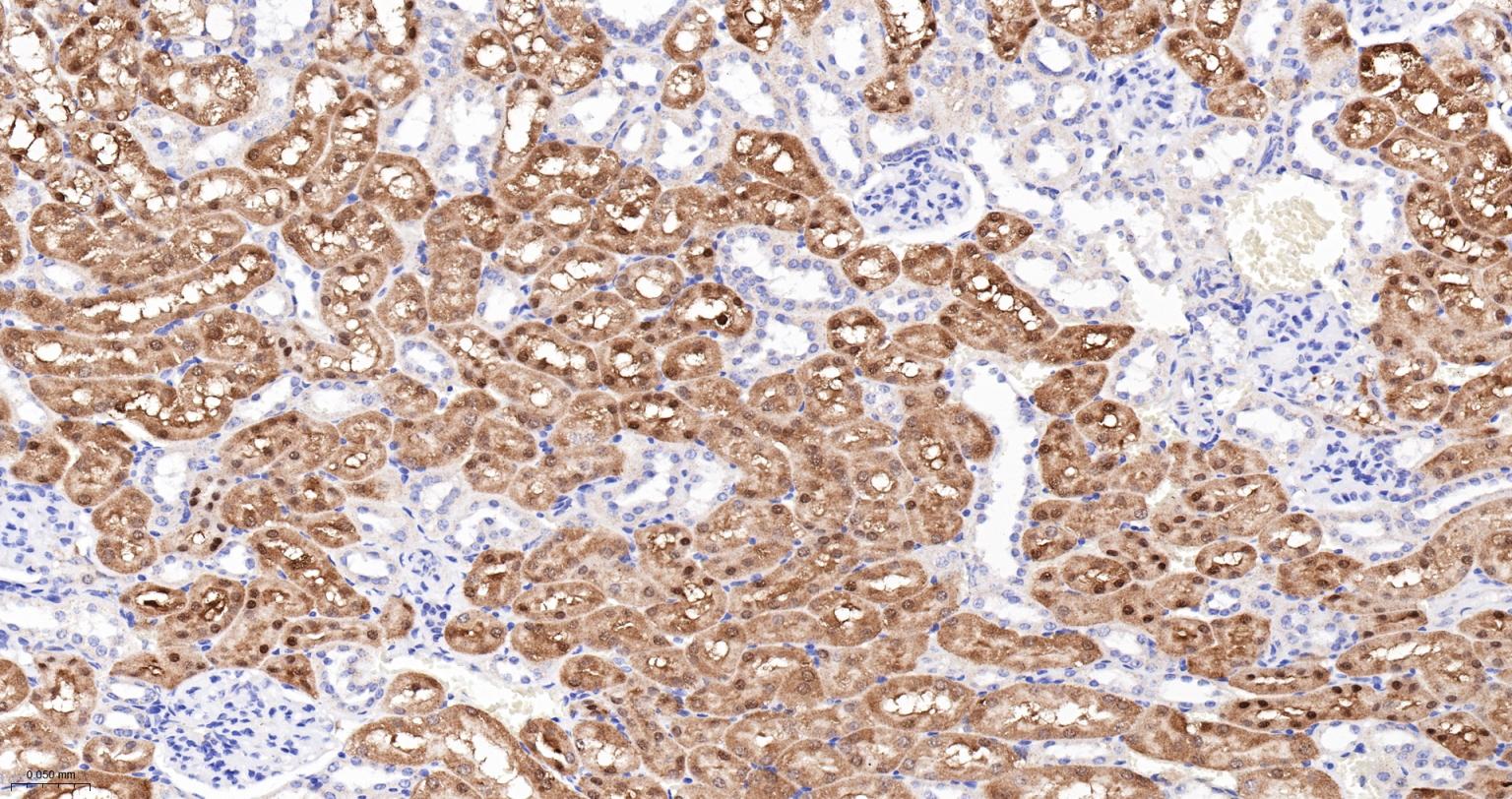 ALKBH1蛋白重组兔单抗-bsm-61168R