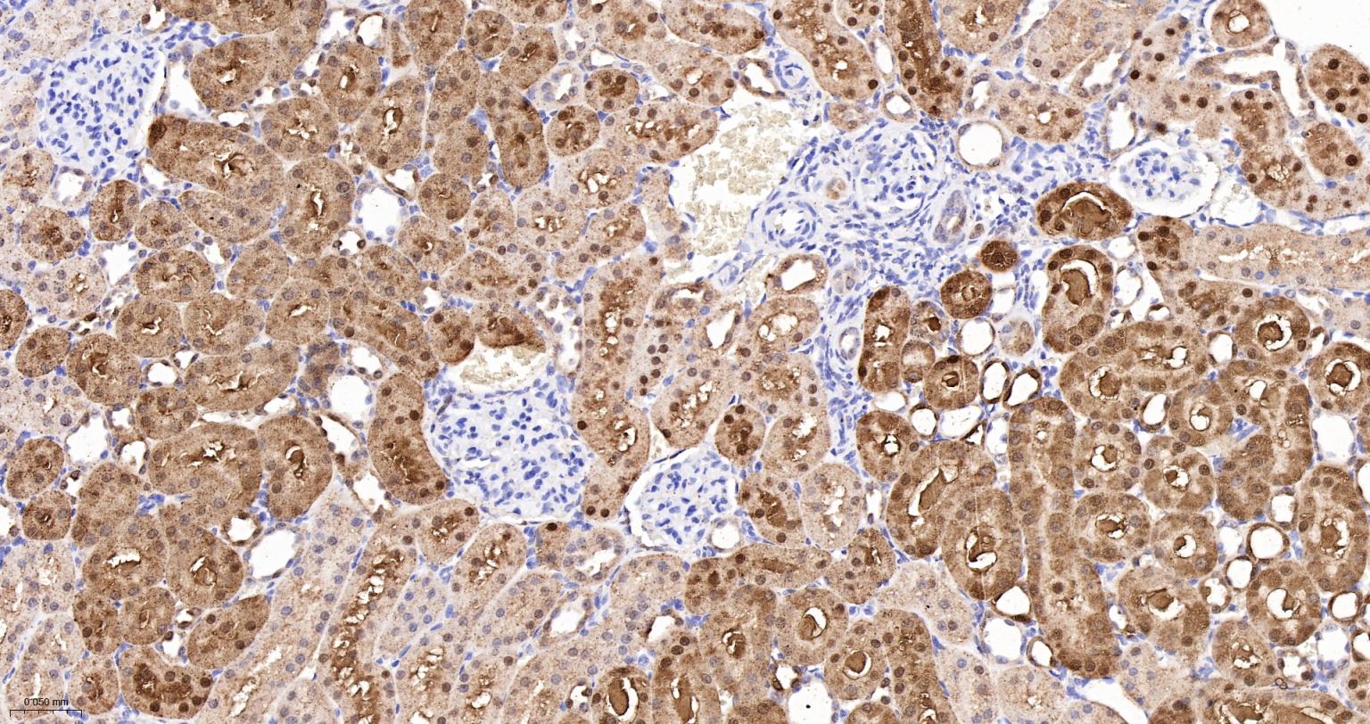 ALKBH1蛋白重组兔单抗-bsm-61168R