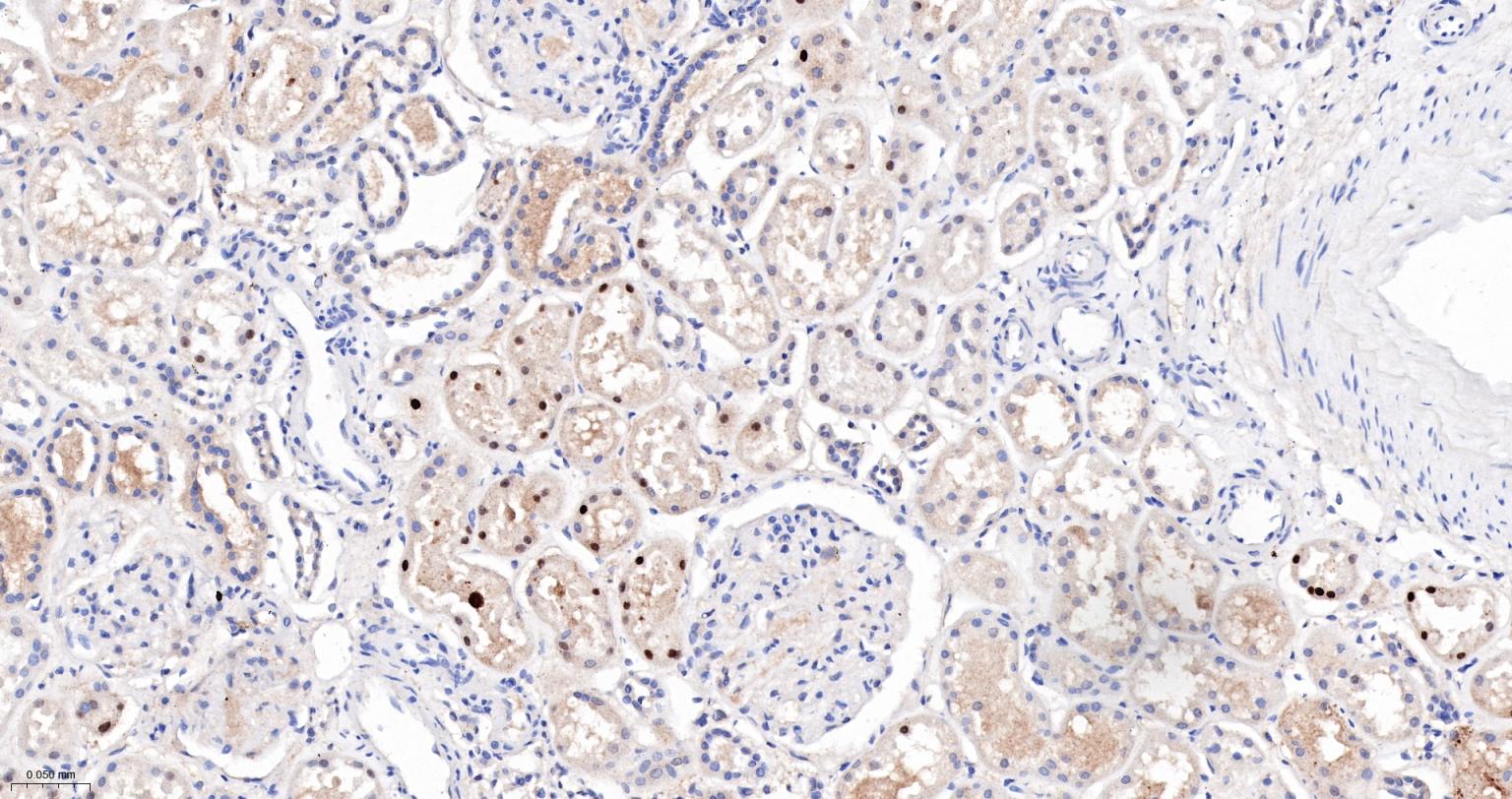 ALKBH1蛋白重组兔单抗-bsm-61168R