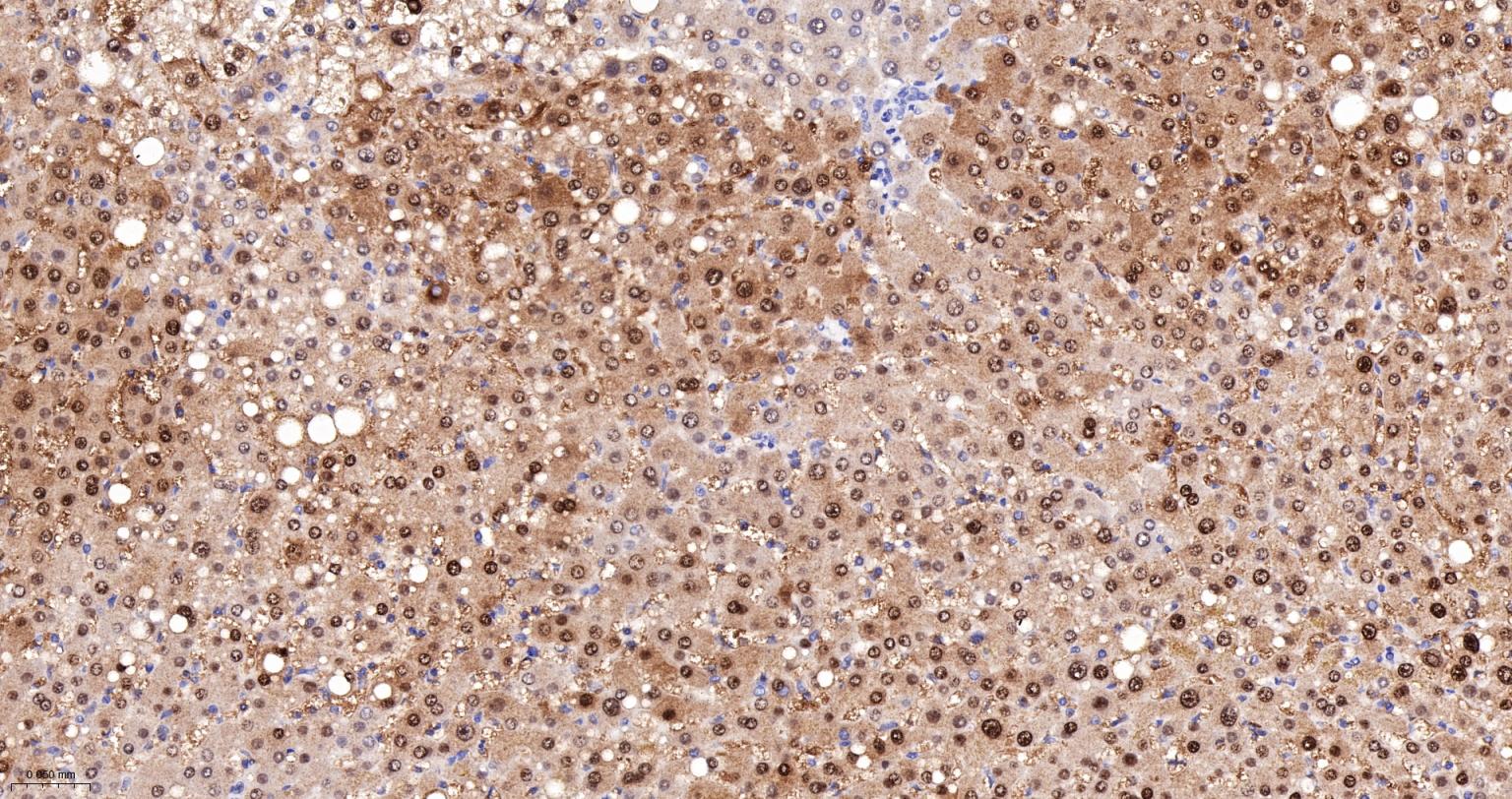 ALKBH1蛋白重组兔单抗-bsm-61168R