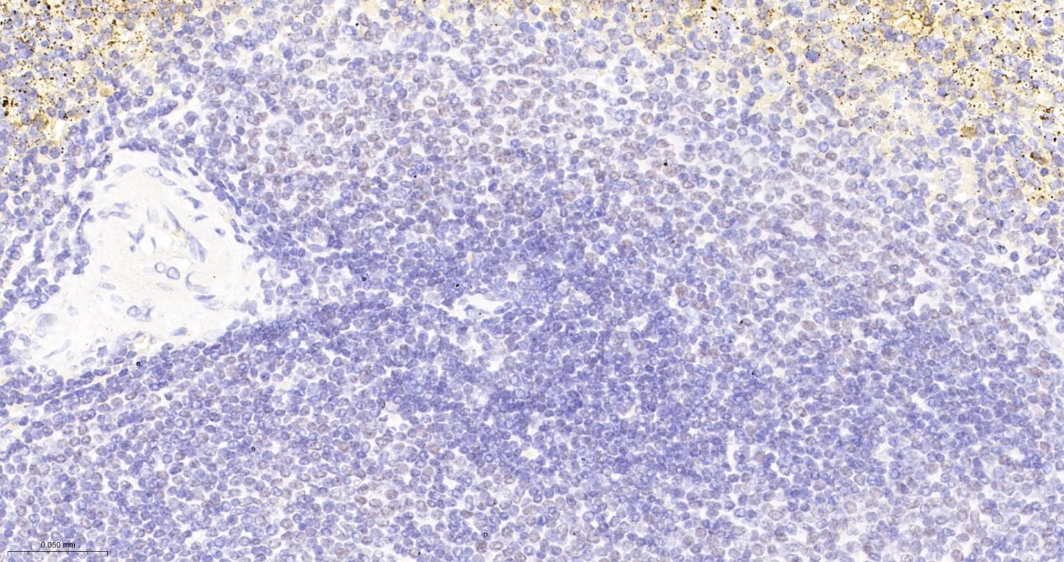 Fas相关死亡结构域蛋白重组兔单抗-bsm-61231R