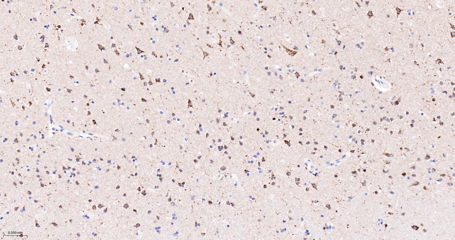 5-脂氧合酶重组兔单抗-bsm-61061R