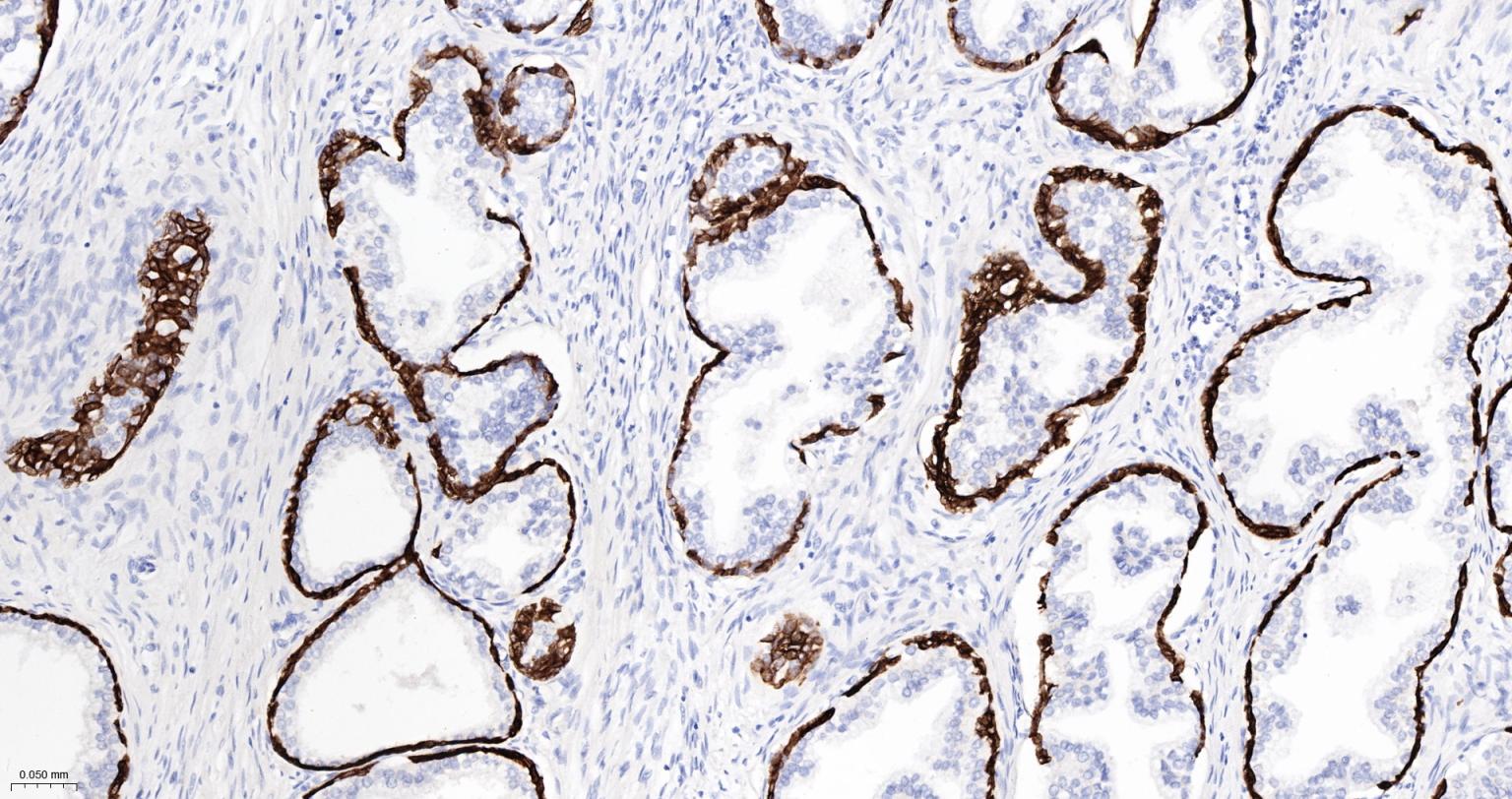 细胞角蛋白5重组兔单抗-bsm-52063R